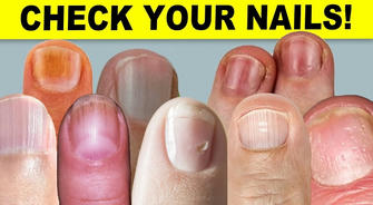 What Your Nails Say About Your Health